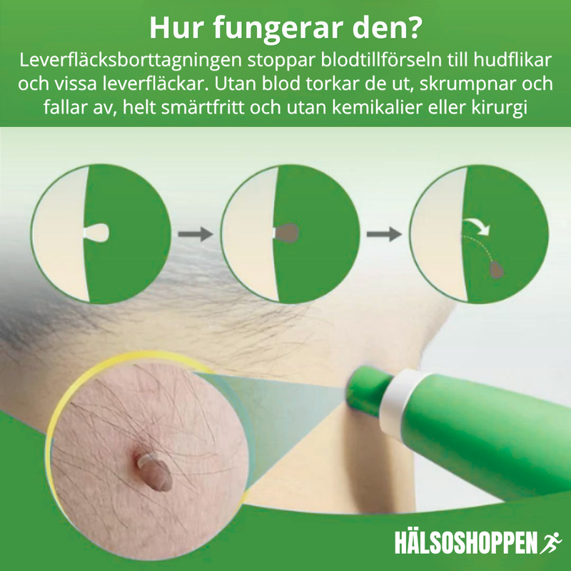 Hudflikskit – Hemmabruk