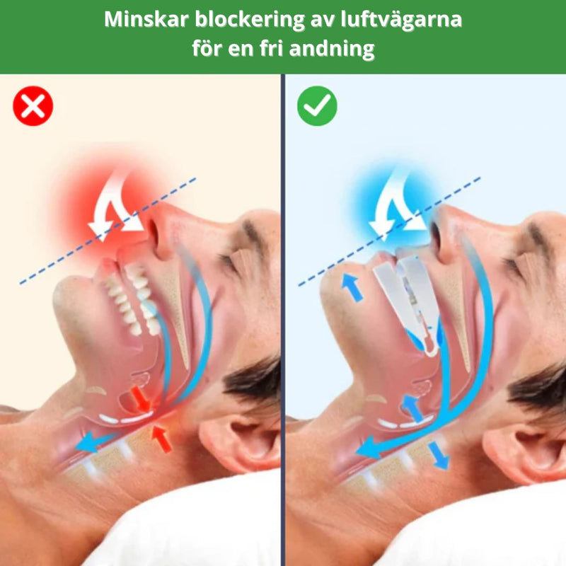 Snarkskena - Snarkskena – För Lugnare och Ostörda Nätter
