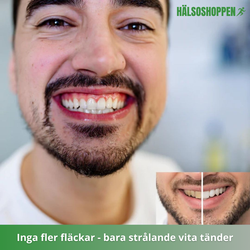 Helautomatisk Tandborste - Effektiv Tandrengöring
